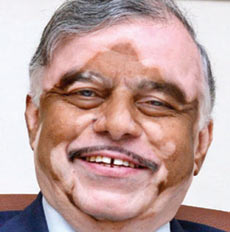 സംസ്ഥാന ചരിത്രത്തില് ആദ്യമായി ഗവര്ണറുടെ വോട്ട് സംസ്ഥാന ചരിത്രത്തില് ആദ്യമായി ഗവര്ണറുടെ വോട്ട്