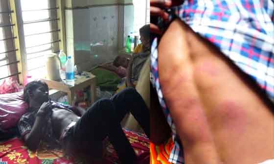 എസ്എന്‍ഡിപി സ്‌കൂളിലെ വിദ്യാര്‍ഥികള്‍ക്ക് മര്‍ദ്ദനം