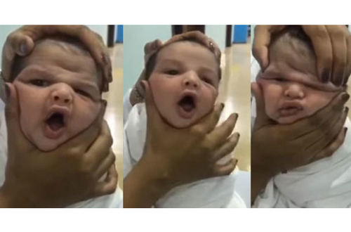 പിഞ്ചുകുഞ്ഞിനെതിരേ നഴ്‌സുമാരുടെ ക്രൂരത: നഴ്‌സിങ് ലൈസന്‍സ് റദ്ദാക്കാന്‍ നിര്‍ദേശം