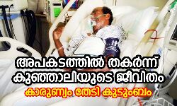 അപകടത്തില്‍ തകര്‍ന്ന് കുഞ്ഞാലിയുടെ പ്രവാസ ജീവിതം; കാരുണ്യം തേടി കുടുംബം