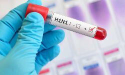 രാജസ്ഥാനില്‍ എച്ച് 1 എന്‍ മരണം 48 ആയി