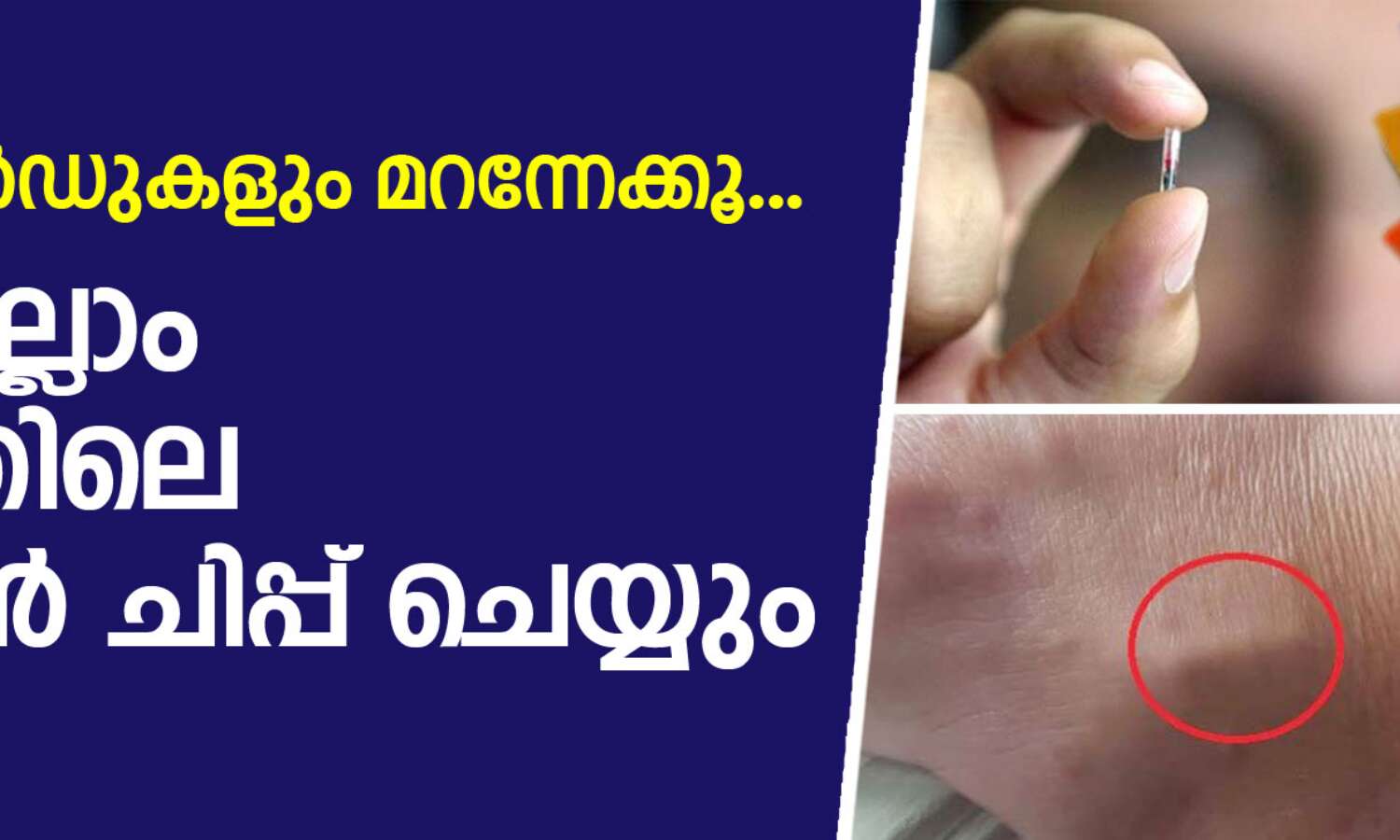 ക്രെഡിറ്റ് കാര്ഡുകളും മറന്നേക്കൂ; ഇനിയെല്ലാം ശരീരത്തിലെ കുഞ്ഞന് ചിപ്പ് ചെയ്യും ക്രെഡിറ്റ് കാര്ഡുകളും മറന്നേക്കൂ; ഇനിയെല്ലാം ശരീരത്തിലെ കുഞ്ഞന് ചിപ്പ് ചെയ്യും