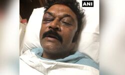 കോണ്‍ഗ്രസ് എംഎല്‍എമാരുടെ തമ്മിലടി;  ജെ എന്‍ ഗണേഷിനെതിരേ ഗുരുതര  ആരോപണവുമായി ആനന്ദ് സിങ്