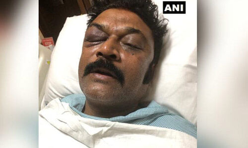 കോണ്‍ഗ്രസ് എംഎല്‍എമാരുടെ തമ്മിലടി;  ജെ എന്‍ ഗണേഷിനെതിരേ ഗുരുതര  ആരോപണവുമായി ആനന്ദ് സിങ്