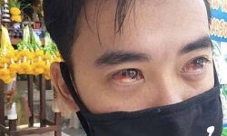 കണ്ണിലൂടെയും മൂക്കിലൂടെയും രക്തം വരുന്നു; അതി രൂക്ഷമായ അന്തരീക്ഷ മലിനീകരണത്തില് പൊറുതിമുട്ടി ബാങ്കോക്ക് കണ്ണിലൂടെയും മൂക്കിലൂടെയും രക്തം വരുന്നു; അതി രൂക്ഷമായ അന്തരീക്ഷ മലിനീകരണത്തില് പൊറുതിമുട്ടി ബാങ്കോക്ക്