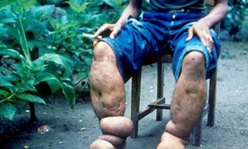 เดชเตเดฐเดฟเดจเตเดคเดฒเตโเดฎเดฃเตเดฃเดฏเดฟเดฒเตโ เดฎเดจเตเดคเต เดฐเตเดเด: เดเดฐเตเดเตเดฏ เดตเดเตเดชเตเดชเต เดเดพเดเตเดฐเดคเดฏเดฟเดฒเตโ เดชเตเดฐเดฟเดจเตเดคเดฒเตโเดฎเดฃเตเดฃเดฏเดฟเดฒเตโ เดฎเดจเตเดคเต เดฐเตเดเด: เดเดฐเตเดเตเดฏ เดตเดเตเดชเตเดชเต เดเดพเดเตเดฐเดคเดฏเดฟเดฒเตโ