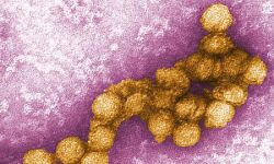 เดตเตเดธเตเดฑเตเดฑเต เดจเตเดฒเตโ เดตเตเดฑเดธเต เดฌเดพเดง: เดชเตเดฐเดคเตเดฏเตเด เดฎเตเดกเดฟเดเตเดเดฒเตโ เดธเดเดเด เดธเดจเตเดฆเดฐเตโเดถเดฟเดเตเดเต เดตเตเดธเตเดฑเตเดฑเต เดจเตเดฒเตโ เดตเตเดฑเดธเต เดฌเดพเดง: เดชเตเดฐเดคเตเดฏเตเด เดฎเตเดกเดฟเดเตเดเดฒเตโ เดธเดเดเด เดธเดจเตเดฆเดฐเตโเดถเดฟเดเตเดเต