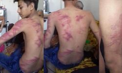 ഗുജറാത്തില് പ്ലസ് ടു പരീക്ഷ എഴുതാനെത്തിയ ദലിത് വിദ്യാര്ഥിക്ക് ക്രൂര മര്ദ്ദനം ഗുജറാത്തില് പ്ലസ് ടു പരീക്ഷ എഴുതാനെത്തിയ ദലിത് വിദ്യാര്ഥിക്ക് ക്രൂര മര്ദ്ദനം