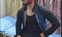 ബംഗളൂരുവില്‍ കശ്മീരി യുവാവിന് ഹിന്ദുത്വസംഘത്തിന്റെ ക്രൂര മര്‍ദ്ദനം