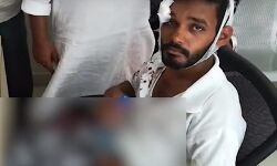 പോക്കറ്റിലിട്ട മൊബൈല്‍ ഫോണ്‍  പൊട്ടിത്തെറിച്ച് യുവാവിന് പരിക്ക്