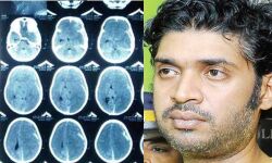 ക്രൂരമര്‍ദനം: ഏഴ് വയസുകാരന്റെ നില അതീവഗുരുതരമായി തുടരുന്നു