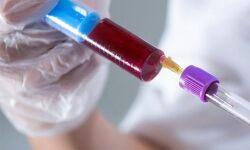 വയനാട്ടില്‍ വീണ്ടും കുരങ്ങുപനി; ആദിവാസി യുവാവ് മരിച്ചു