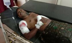 കാട് വെട്ടിത്തെളിക്കുന്നതിനിടെ ബോംബ് പൊട്ടി ഒരാള്ക്ക് പരിക്ക് കാട് വെട്ടിത്തെളിക്കുന്നതിനിടെ ബോംബ് പൊട്ടി ഒരാള്ക്ക് പരിക്ക്