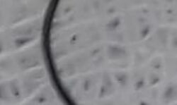 തിരുവനന്തപുരം മെഡിക്കല്‍ കോളജ് ആശുപത്രിയില്‍ അതി സങ്കീര്‍ണ്ണ ശസ്ത്രക്രിയ; ഭക്ഷണത്തോടൊപ്പം ഉള്ളില്‍ കടന്ന നേരിയകമ്പിക്കഷണം പുറത്തെടുത്തു