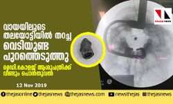 വായയിലൂടെ തലയോട്ടിയില്‍ തറച്ച വെടിയുണ്ട പുറത്തെടുത്തു; മെഡി.കോളജ് ആശുപത്രിക്ക് വീണ്ടും പൊന്‍തൂവല്‍