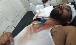 കെഎസ്യു നടത്തിയ നിയമസഭാ മാര്ച്ചില് സംഘര്ഷം; ഷാഫി പറമ്പിൽ എംഎൽഎക്ക് പരിക്ക്, അന്വേഷിക്കാമെന്ന് മന്ത്രി കെഎസ്യു നടത്തിയ നിയമസഭാ മാര്ച്ചില് സംഘര്ഷം; ഷാഫി പറമ്പിൽ എംഎൽഎക്ക് പരിക്ക്, അന്വേഷിക്കാമെന്ന് മന്ത്രി