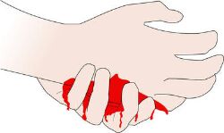 പമ്പ് ഹൗസ് നിര്‍മാണ പ്രവൃത്തിക്കിടെ മണ്ണിടിഞ്ഞ് തൊഴിലാളിക്ക് പരിക്ക്: മൂന്ന് പേര്‍ അല്‍ഭുതകരമായി രക്ഷപ്പെട്ടു