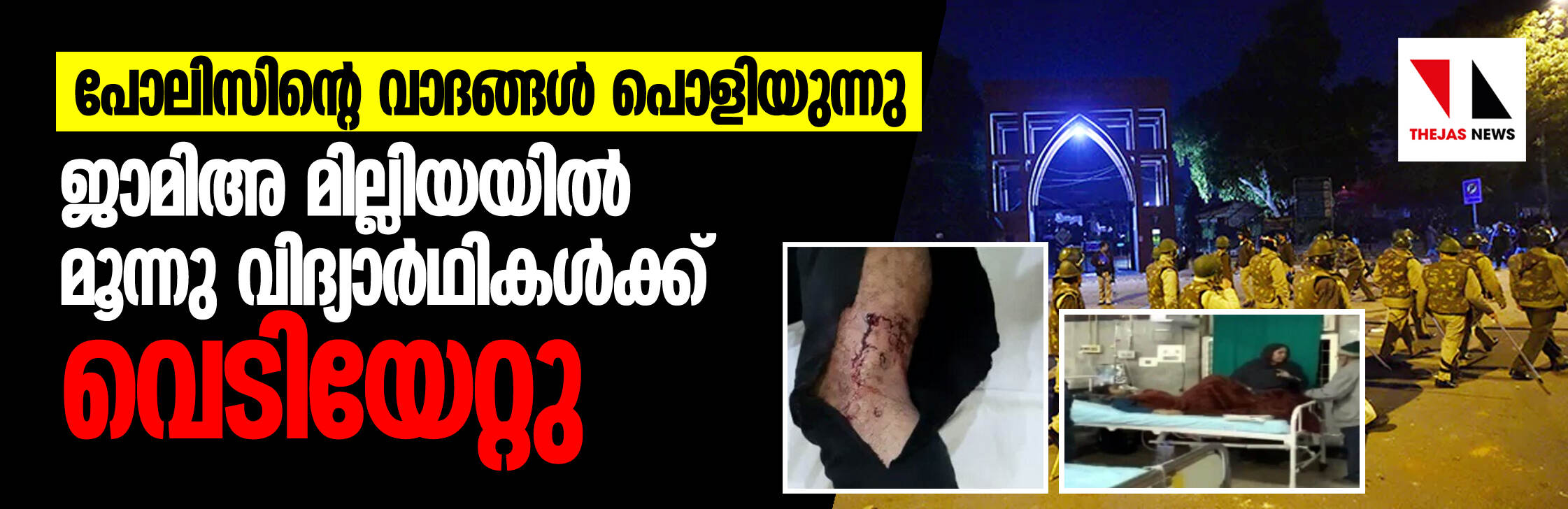 ജാമിഅ മില്ലിയ്യയില് വെടിയേറ്റത് മൂന്ന് കുട്ടികള്ക്ക്; പോലിസിന്റെ വാദങ്ങള് പൊളിയുന്നു ജാമിഅ മില്ലിയ്യയില് വെടിയേറ്റത് മൂന്ന് കുട്ടികള്ക്ക്; പോലിസിന്റെ വാദങ്ങള് പൊളിയുന്നു