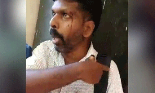 മര്ദനമേറ്റ വിവരാവകാശ പ്രവര്ത്തകന് നേരെ വീണ്ടും മണ്ണ് മാഫിയയുടെ ഭീഷണി മര്ദനമേറ്റ വിവരാവകാശ പ്രവര്ത്തകന് നേരെ വീണ്ടും മണ്ണ് മാഫിയയുടെ ഭീഷണി