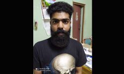 ലഹരി മരുന്നുമായി യുവാവ് എക്‌സൈസിന്റെ പിടിയില്‍