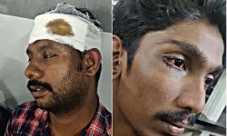 തിരുവനന്തപുരത്ത് ആര്എസ്എസ് ആക്രമണത്തില് മൂന്ന് സിപിഎം- ഡിവൈഎഫ്ഐ പ്രവര്ത്തകര്ക്ക് പരിക്ക് തിരുവനന്തപുരത്ത് ആര്എസ്എസ് ആക്രമണത്തില് മൂന്ന് സിപിഎം- ഡിവൈഎഫ്ഐ പ്രവര്ത്തകര്ക്ക് പരിക്ക്