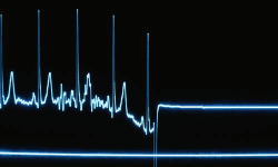 കെഎസ്ഇബി ജീവനക്കാരന്‍ ഷോക്കേറ്റ് മരിച്ചു