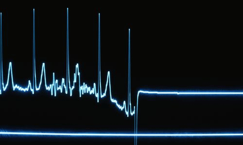 കെഎസ്ഇബി ജീവനക്കാരന് ഷോക്കേറ്റ് മരിച്ചു കെഎസ്ഇബി ജീവനക്കാരന് ഷോക്കേറ്റ് മരിച്ചു