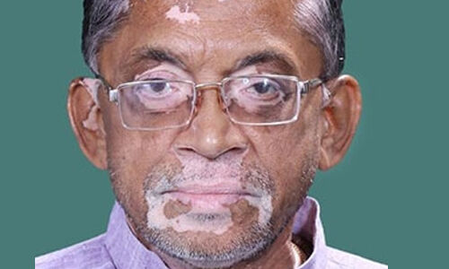 തൊഴിലില്ലായ്മയെ കുറിച്ചുള്ള ചോദ്യത്തില്‍ നിന്ന് ഒഴിഞ്ഞുമാറി കേന്ദ്ര തൊഴില്‍വകുപ്പ് മന്ത്രി