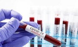 കൊവിഡ് 19: രാജ്യത്ത് 62 പരിശോധനാകേന്ദ്രങ്ങള്; കേരളത്തില് നാലെണ്ണം കൊവിഡ് 19: രാജ്യത്ത് 62 പരിശോധനാകേന്ദ്രങ്ങള്; കേരളത്തില് നാലെണ്ണം