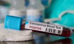 ഒരാള്‍ക്ക് കൊറോണ സ്ഥിരീകരിച്ചു; ഗ്രാമം തന്നെ അടച്ചുപൂട്ടി ജില്ലാ ഭരണകൂടം