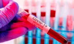 പയ്യന്നൂര്‍ സ്വദേശിക്ക് കൊവിഡ്; പരപ്പനങ്ങാടിയില്‍ മൂന്നുപേര്‍ നിരീക്ഷണത്തില്‍