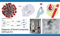 കൊവിഡ് 19 പരിശോധന വേഗത്തിലാക്കാന്‍ 10 പിസിആര്‍ മെഷീനുകള്‍