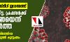 നിസാമുദ്ദീന് തബ്ലീഗ് ജമാഅത്ത്: കൊല്ലത്തെ റിട്ട. പ്രഫസര്ക്ക് കൊറോണയെന്ന് വ്യാജവാര്ത്ത; മലയാള ദിനപത്രത്തിനെതിരേ നിയമനടപടിക്കൊരുങ്ങി കുടുംബം നിസാമുദ്ദീന് തബ്ലീഗ് ജമാഅത്ത്: കൊല്ലത്തെ റിട്ട. പ്രഫസര്ക്ക് കൊറോണയെന്ന് വ്യാജവാര്ത്ത; മലയാള ദിനപത്രത്തിനെതിരേ നിയമനടപടിക്കൊരുങ്ങി കുടുംബം