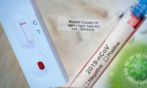 കൊവിഡ് വ്യാപനം: പരിശോധനാ കിറ്റുകള്‍ കയറ്റുമതി ചെയ്യുന്നതിന് കേന്ദ്രസര്‍ക്കാര്‍ നിയന്ത്രണം