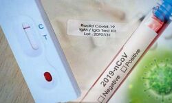 കൊവിഡ് വ്യാപനം: പരിശോധനാ കിറ്റുകള്‍ കയറ്റുമതി ചെയ്യുന്നതിന് കേന്ദ്രസര്‍ക്കാര്‍ നിയന്ത്രണം