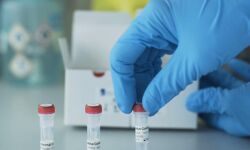 കൊവിഡ് 19: മലപ്പുറം ജില്ലയില്‍ സാംപിള്‍ പരിശോധന സംവിധാനം സജ്ജമാകുന്നു