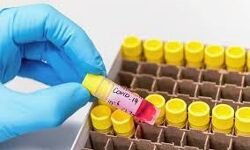 കൊവിഡ് 19: വയനാട്ടില് 338 പേര് കൂടി നിരീക്ഷണത്തില് കൊവിഡ് 19: വയനാട്ടില് 338 പേര് കൂടി നിരീക്ഷണത്തില്