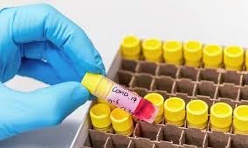 കൊവിഡ് 19: വയനാട്ടില്‍ 338 പേര്‍ കൂടി നിരീക്ഷണത്തില്‍