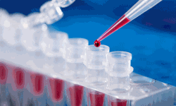 യുപിയില്‍ അഞ്ച് ജില്ലകളെ കൊറോണ മുക്തമായി പ്രഖ്യാപിച്ചു