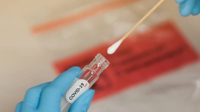 ഹോട്ട്സ്പോട്ടുകളില്‍ നിന്ന് 359 സാംപിളുകള്‍ പരിശോധനയ്ക്ക് അയച്ചു