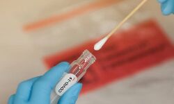 ഹോട്ട്സ്പോട്ടുകളില്‍ നിന്ന് 359 സാംപിളുകള്‍ പരിശോധനയ്ക്ക് അയച്ചു