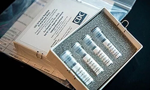 കൊവിഡ് 19: മെയ് ഒന്നു മുതല് സൗദിയിലെ താമസസ്ഥലങ്ങളില് വ്യാപകപരിശോധന കൊവിഡ് 19: മെയ് ഒന്നു മുതല് സൗദിയിലെ താമസസ്ഥലങ്ങളില് വ്യാപകപരിശോധന