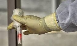 ഉത്തര്‍പ്രദേശില്‍ ആദ്യമായി പ്ലാസ്മ ചികില്‍സക്ക് വിധേയനായ ഡോക്ടര്‍ മരിച്ചു