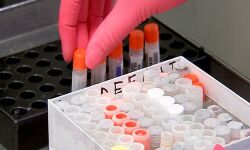 24 เดฎเดฃเดฟเดเตเดเตเดฑเดฟเดจเตเดณเดณเดฟเดฒเตโ เดเตเดเดฑเดพเดคเตเดคเดฟเดฒเตโ 324 เดชเตเดฐเตโเดเตเดเต เดเตเดตเดฟเดกเต เดธเตเดฅเดฟเดฐเตเดเดฐเดฟเดเตเดเต 24 เดฎเดฃเดฟเดเตเดเตเดฑเดฟเดจเตเดณเดณเดฟเดฒเตโ เดเตเดเดฑเดพเดคเตเดคเดฟเดฒเตโ 324 เดชเตเดฐเตโเดเตเดเต เดเตเดตเดฟเดกเต เดธเตเดฅเดฟเดฐเตเดเดฐเดฟเดเตเดเต