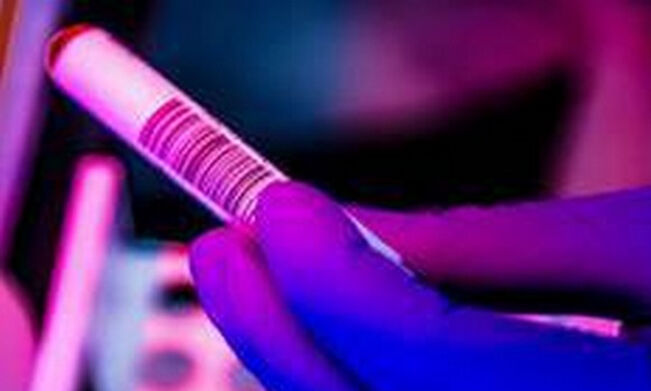 കൊവിഡ് 19: കര്‍ണാടകയില്‍ ഇന്ന് 69 പേര്‍ക്ക് രോഗം സ്ഥിരീകരിച്ചു