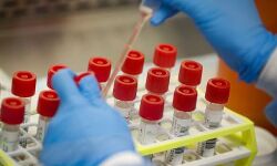 കര്‍ണാടകയില്‍ പ്ലാസ്മ തെറാപ്പിക്ക് വിധേയനായ രോഗി മരിച്ചു