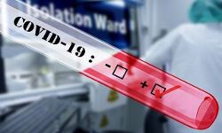 കൊവിഡ് 19: തിരുവനന്തപുരം ജില്ലയില് പുതുതായി 535 പേര് നിരീക്ഷണത്തില് കൊവിഡ് 19: തിരുവനന്തപുരം ജില്ലയില് പുതുതായി 535 പേര് നിരീക്ഷണത്തില്