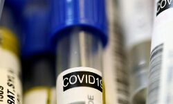 കൊവിഡ് 19: 11 നഗരങ്ങളില്‍ നിന്നുളള കുടിയേറ്റത്തൊഴിലാളികള്‍ക്ക് പ്രത്യേക നിരീക്ഷണമേര്‍പ്പെടുത്തുമെന്ന് ബീഹാര്‍