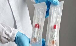 കൊവിഡ്: ആറ് കേന്ദ്രങ്ങളില്‍ സാംപിള്‍ ശേഖരണം രാത്രി എട്ടുവരെ