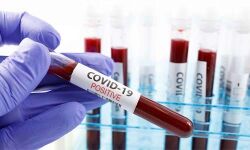 കൊവിഡ്-19 പരിശോധനകള്‍ ശക്തിപ്പെടുത്താന്‍ ആരോഗ്യവകുപ്പില്‍ 150 തസ്തികകള്‍